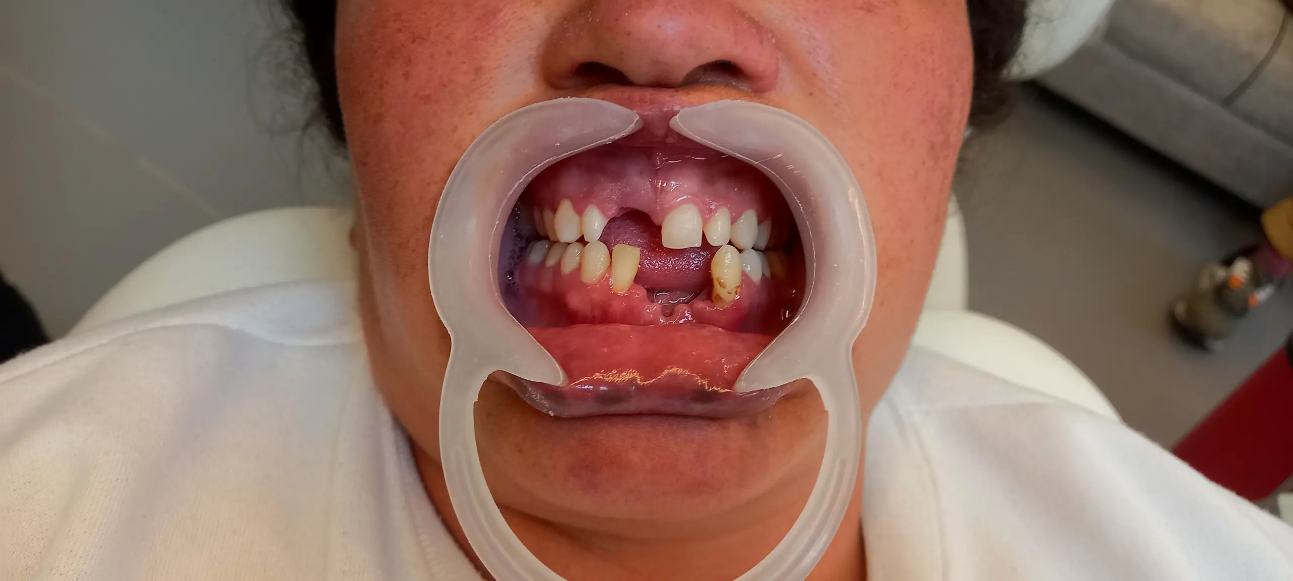 Registro odontológico de la sonrisa de Leydi; imagen que enlaza al Reel original